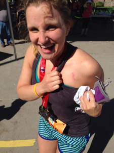 Kendall showing off her pacemaker after the half-marathon